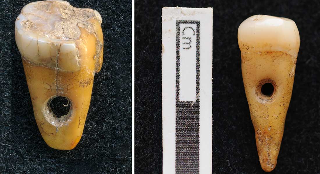 De to 8.500 år gamle gennemborede mennesketænder, som blev fundet i  Çatalhöyük i Tyrkiet. Foto: Københavns Universitet
